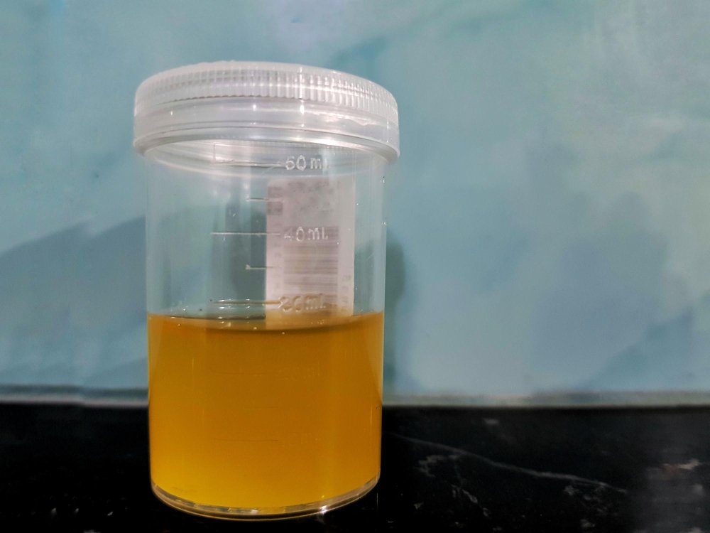 Paruošimas: ką turi žinoti šeimininkas prieš ėmimą